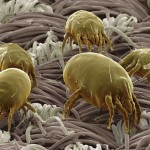 Dust Mites: Serious Allergens in Your Home