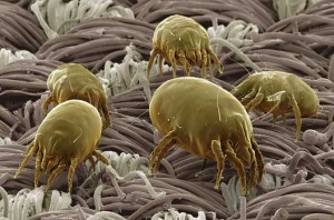 Read more about the article Dust Mites: Serious Allergens in Your Home